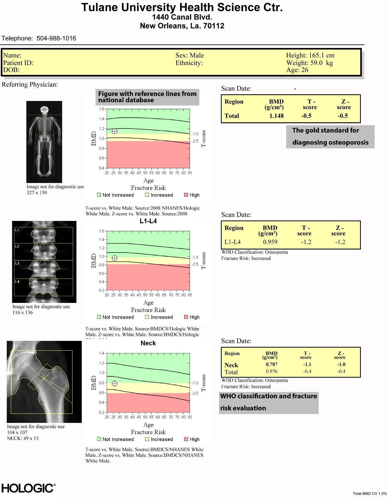 Sample bone density report