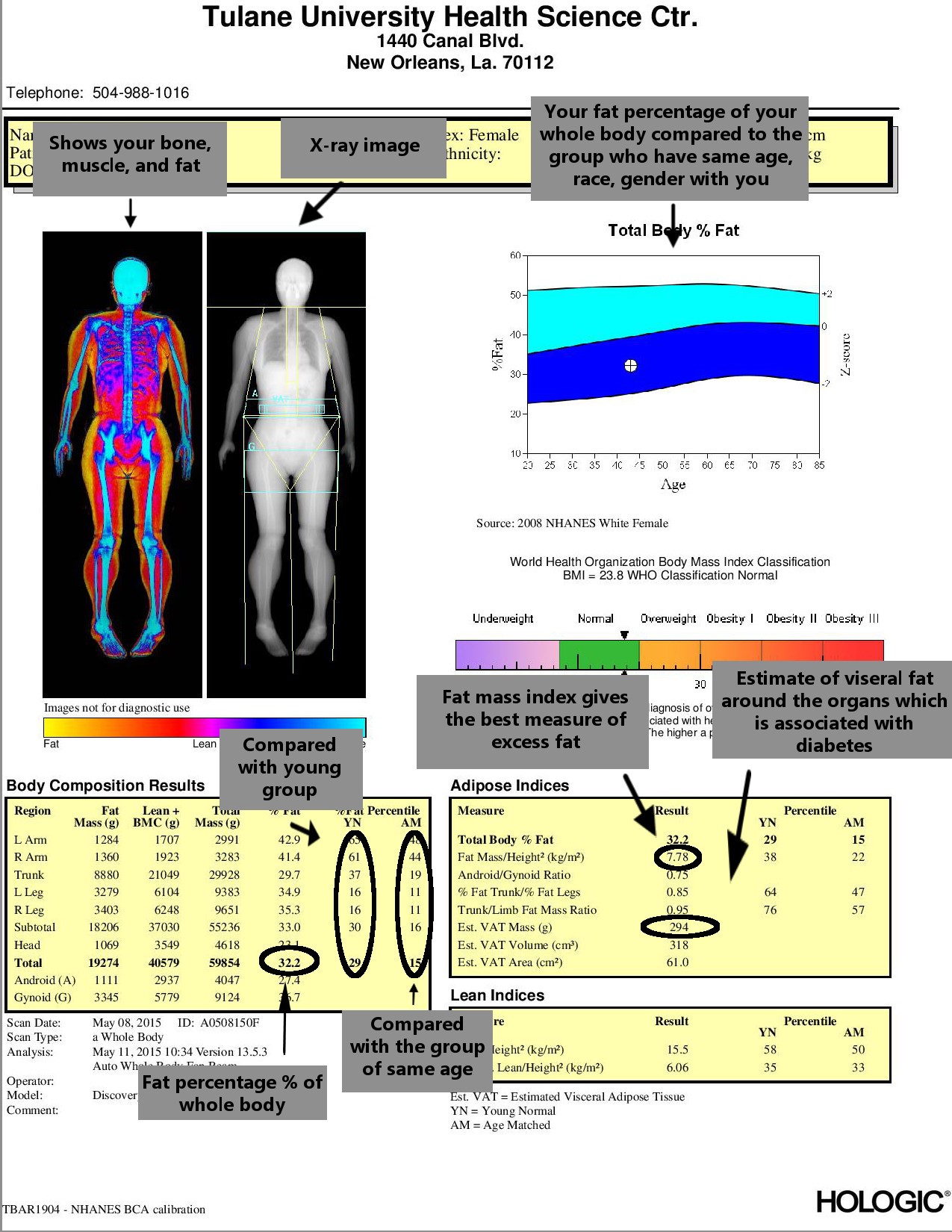 Sample body composition report with explanation